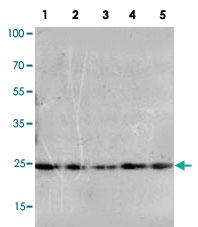 Anti-FGF10 Rabbit Polyclonal Antibody