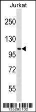 Anti-CENPC Rabbit Polyclonal Antibody (PE (Phycoerythrin))