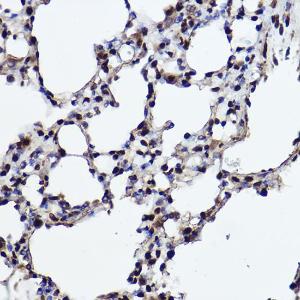 Immunohistochemistry analysis of paraffin-embedded rat lung using Anti-RanBP3 Antibody [ARC2496] (A306855) at a dilution of 1:100 (40X lens). Perform high pressure antigen retrieval with 10 mM citrate buffer pH 6.0 before commencing with IHC staining protocol