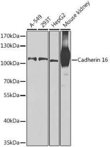 Western blot analysis of extracts of various cell lines, using Anti-Cadherin 16 Antibody (A12184) at 1:1000 dilution