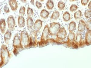 Anti-beta Catenin Mouse Monoclonal Antibody [clone: CTNNB1/1507]