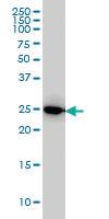 Anti-IL27 Mouse Monoclonal Antibody [clone: 3F12]