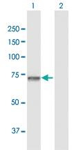 Anti-GNPAT Rabbit Polyclonal Antibody