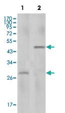 Anti-IL2 Mouse Monoclonal Antibody [clone: 8D5]