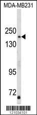 Anti-TBC1D4 Rabbit Polyclonal Antibody (FITC (Fluorescein))