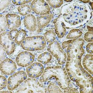 Immunohistochemistry analysis of paraffin-embedded rat kidney using Anti-Cadherin 16 Antibody (A12184) at a dilution of 1:100 (40x lens). Perform microwave antigen retrieval with 10 mM PBS buffer pH 7.2 before commencing with IHC staining protocol