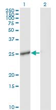 Anti-IL27 Mouse Monoclonal Antibody [clone: 3F12]