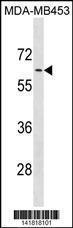 Anti-ADRA1B Rabbit Polyclonal Antibody (HRP (Horseradish Peroxidase))