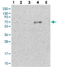 Anti-ETFDH Rabbit Polyclonal Antibody