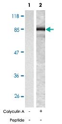 Anti-CTNNB1 Rabbit Polyclonal Antibody