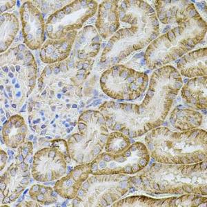 Immunohistochemistry analysis of paraffin-embedded mouse kidney using Anti-Cadherin 16 Antibody (A12184) at a dilution of 1:100 (40x lens). Perform microwave antigen retrieval with 10 mM PBS buffer pH 7.2 before commencing with IHC staining protocol