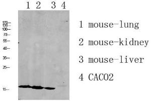 Antibody anti-RPL35 A97273-100 100 µg