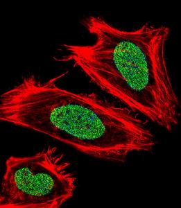 Anti-UHRF1 Rabbit Polyclonal Antibody (FITC (Fluorescein))