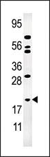 Anti-AK1 Rabbit Polyclonal Antibody [clone: 275CT1]