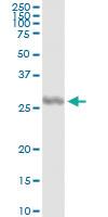 Anti-IL27 Mouse Monoclonal Antibody [clone: 3F12]