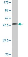 Anti-TPI1 Mouse Monoclonal Antibody [clone: 2C3]