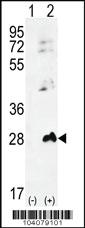 Anti-AK1 Rabbit Polyclonal Antibody [clone: 275CT1]