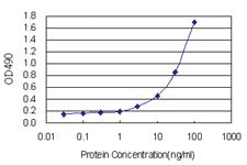 Anti-E4F1 Antibody Pair