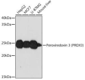 Anti-Peroxiredoxin 3/PRDX3 Rabbit Monoclonal Antibody [clone: ARC0747]