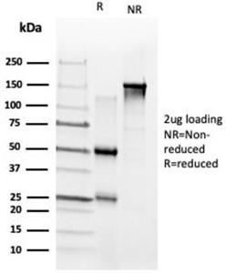 SDS-PAGE analysis of Anti-ZNF704 Antibody [PCRP-ZNF704-3C10] under non-reduced and reduced conditions; showing intact IgG and intact heavy and light chains, respectively. SDS-PAGE analysis confirms the integrity and purity of the antibody