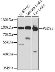 Western blot analysis of extracts of various cell lines, using Anti-PSD95 Antibody (A12185) at 1:1,000 dilution