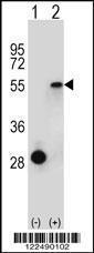 Anti-ESRRA Rabbit Polyclonal Antibody (APC (Allophycocyanin))