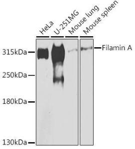 Western blot analysis of extracts of various cell lines, using Anti-Filamin A Antibody (A12186) at 1:500 dilution