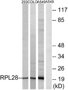 Western blot analysis of lysates from A549, 293, and COLO cells using Anti-RPL28 Antibody. The right hand lane represents a negative control, where the antibody is blocked by the immunising peptide