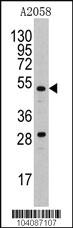 Anti-PLAU Rabbit Polyclonal Antibody