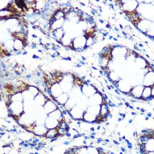 Anti-Peroxiredoxin 3/PRDX3 Rabbit Monoclonal Antibody [clone: ARC0747]