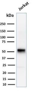 Western blot analysis of human Jurkat cell lysate using Anti-Cyclin E Antibody [CCNE1/2460]