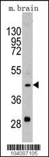 Anti-PLAU Rabbit Polyclonal Antibody