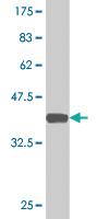 Anti-CLIC3 Mouse Monoclonal Antibody [clone: 2C5]