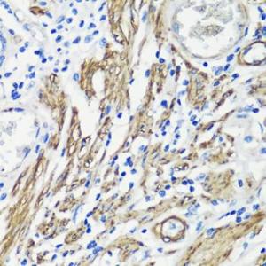 Immunohistochemistry analysis of paraffin-embedded human colon muscle using Anti-Filamin A Antibody (A12186) at a dilution of 1:100 (40X lens). Perform microwave antigen retrieval with 10 mM PBS buffer pH 7.2 before commencing with IHC staining protocol