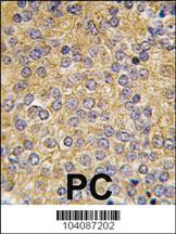 Anti-PLAU Rabbit Polyclonal Antibody