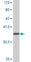 Anti-VAT1 Mouse Polyclonal Antibody