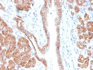 Immunohistochemical analysis of formalin-fixed, paraffin-embedded human pancreas using Anti-beta Catenin Antibody [CTNNB1/1508]