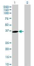 Anti-ING2 Mouse Polyclonal Antibody