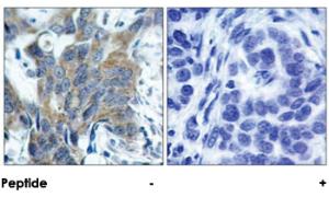 Anti-CTNNB1 Rabbit Polyclonal Antibody