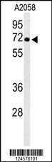 Anti-ATP6V1A Rabbit Polyclonal Antibody (AP (Alkaline Phosphatase))