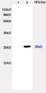 Anti-IgL Rabbit Polyclonal Antibody