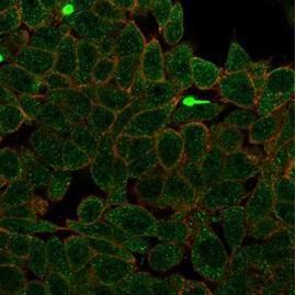 Immunofluorescent analysis of PFA-fixed HeLa cells stained with Anti-ZNF704 Antibody [PCRP-ZNF704-3C10] followed by Goat Anti-Mouse IgG (CFand#174; 488) (Green). CF640 Phalloidin (red)