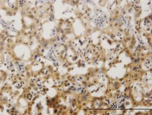 Anti-ZNF496 Mouse Monoclonal Antibody [clone: 2B3]