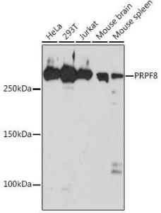 Anti-PRPF8/Prp8 Rabbit Monoclonal Antibody [clone: ARC1038]