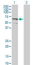 Anti-DYRK2 Mouse Monoclonal Antibody [clone: 2F9]