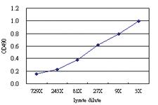 Anti-STK25 Antibody Pair