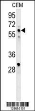 Anti-IKZF1 Rabbit Polyclonal Antibody (Biotin)