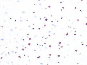 Anti-PRPF8/Prp8 Rabbit Monoclonal Antibody [clone: ARC1038]