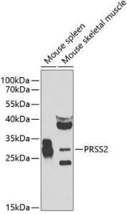 Western blot analysis of extracts of various cell lines, using Anti-PRSS2 Antibody (A12187) at 1:1,000 dilution. The secondary antibody was Goat Anti-Rabbit IgG H&L Antibody (HRP) at 1:10,000 dilution.