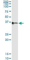 Anti-CRHBP Antibody Pair